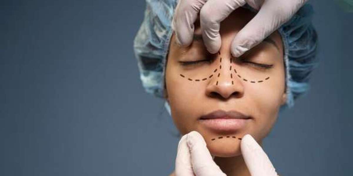 Sculpting Elegance: Unveiling the Nose Job Prices in Turkey