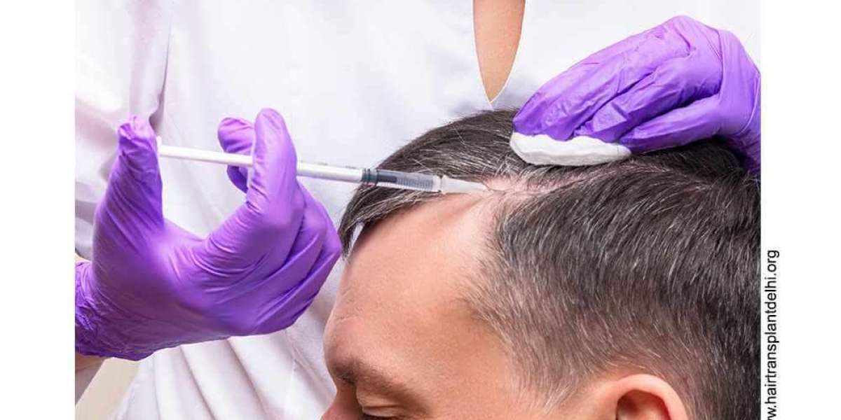 Success Of PRP Hair Treatment In India
