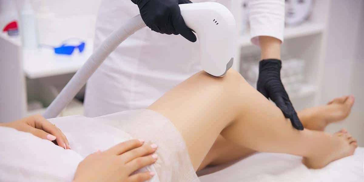 Laser Hair Removal in Dubai: A Beacon of Beauty Innovation