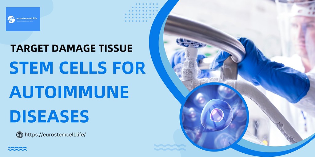 Target Damage Tissue with Stem Cells for Autoimmune Diseas… | Flickr