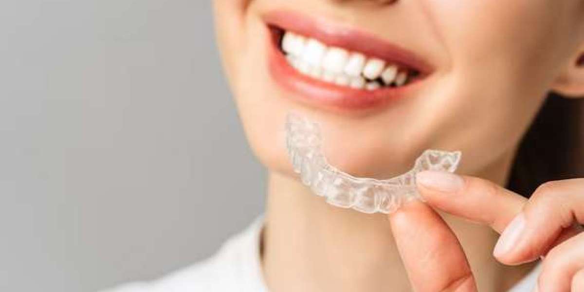 Sunny Days, Clear Smiles: Embracing Invisalign in Miami