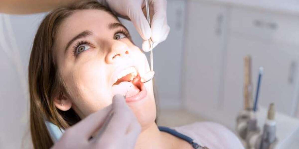 3 FAQs About Root Canal Treatment