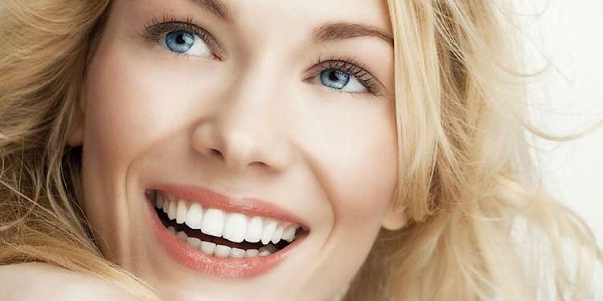 Starry Grins: The Ultimate Hollywood Smile Makeover