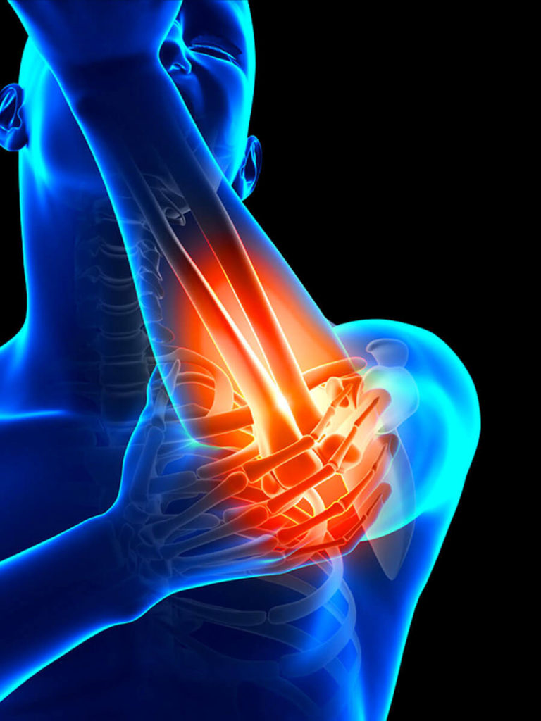 5 Reasons Behind Elbow Pain & How To Treat that! – Dr Sumit Badhwar