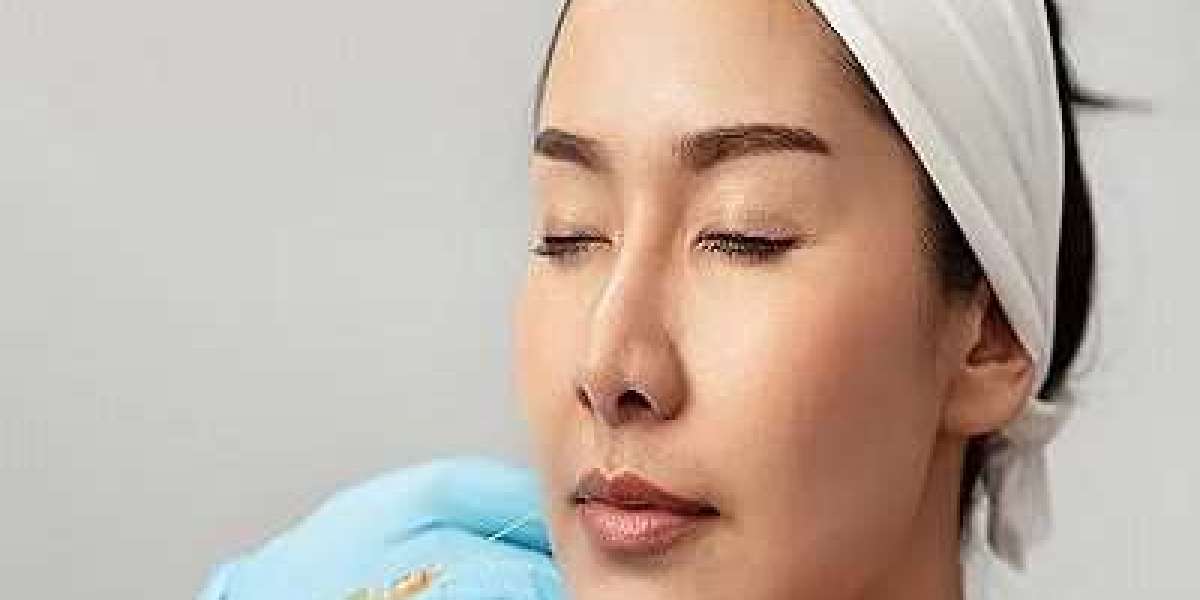 Understanding the Cost of Volift Fillers: Investment in Timeless Beauty
