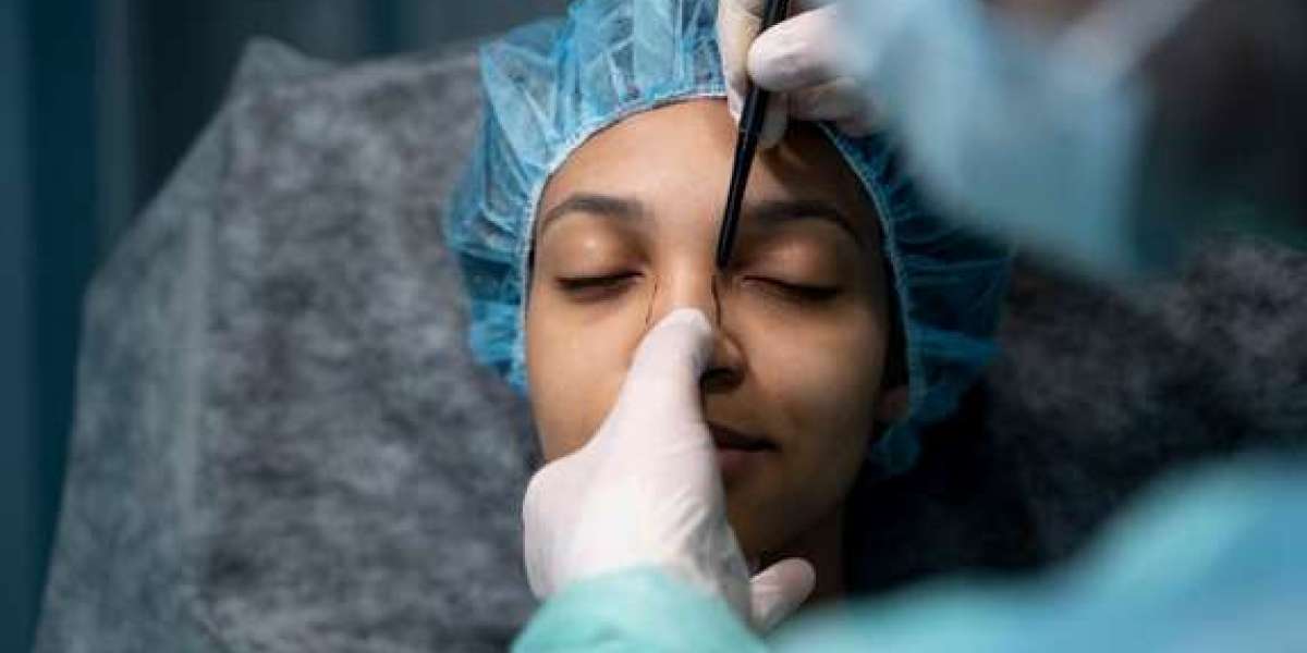 Nose Job Nirvana: Exploring Prices and Perfection in Turkey