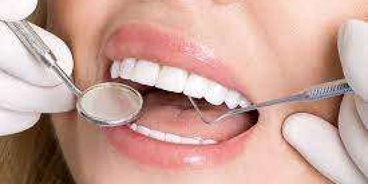 عيادة فينير الأسنان الرائدة في دبي للحصول على ابتسامات مذهلة