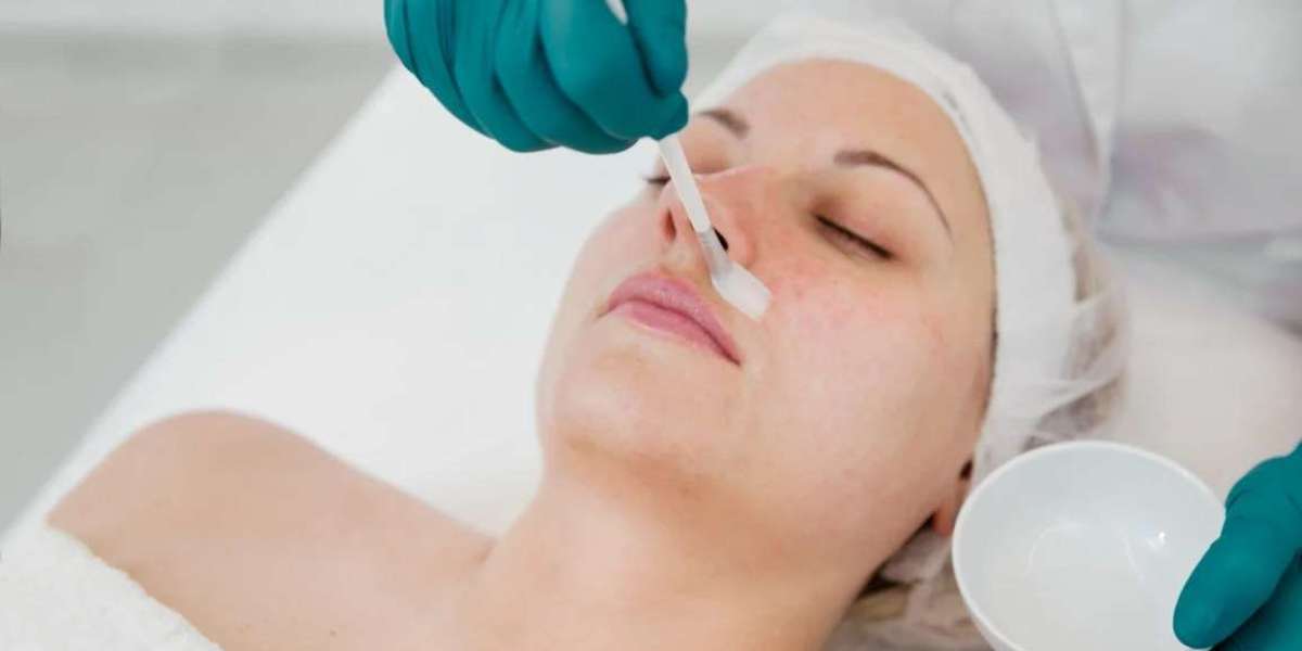 "Skin Revival: Superficial Chemical Peels for a Fresh Start"