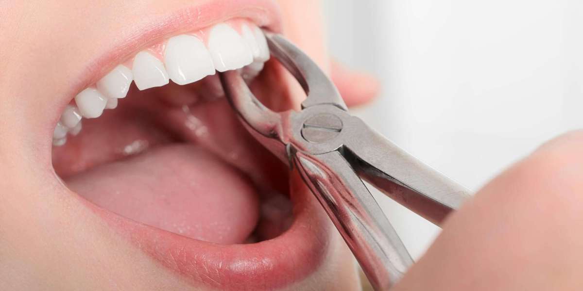 Tooth Extraction Recovery Tips for a Smooth Healing Process