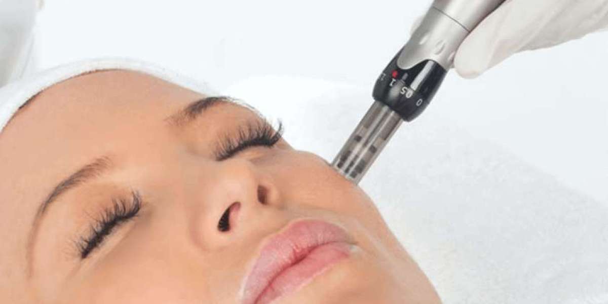 Microneedling Mastery: The Dermapen Advantage Unveiled