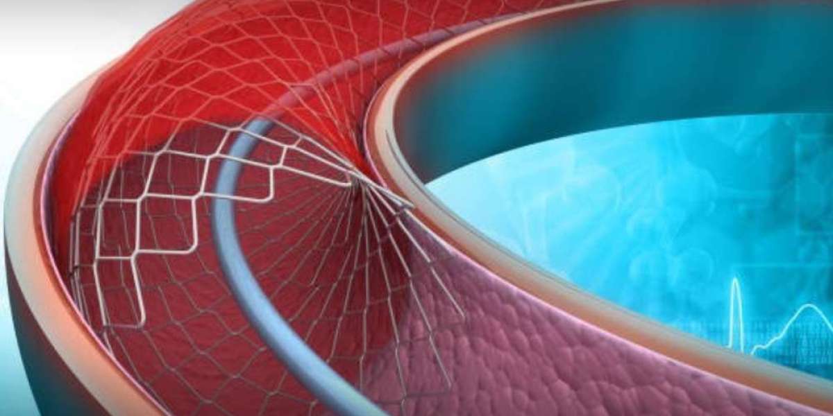 Percutaneous Coronary Intervention Market: Unveiling the USD 16.7 Billion Story with 7.2% CAGR Brushstrokes