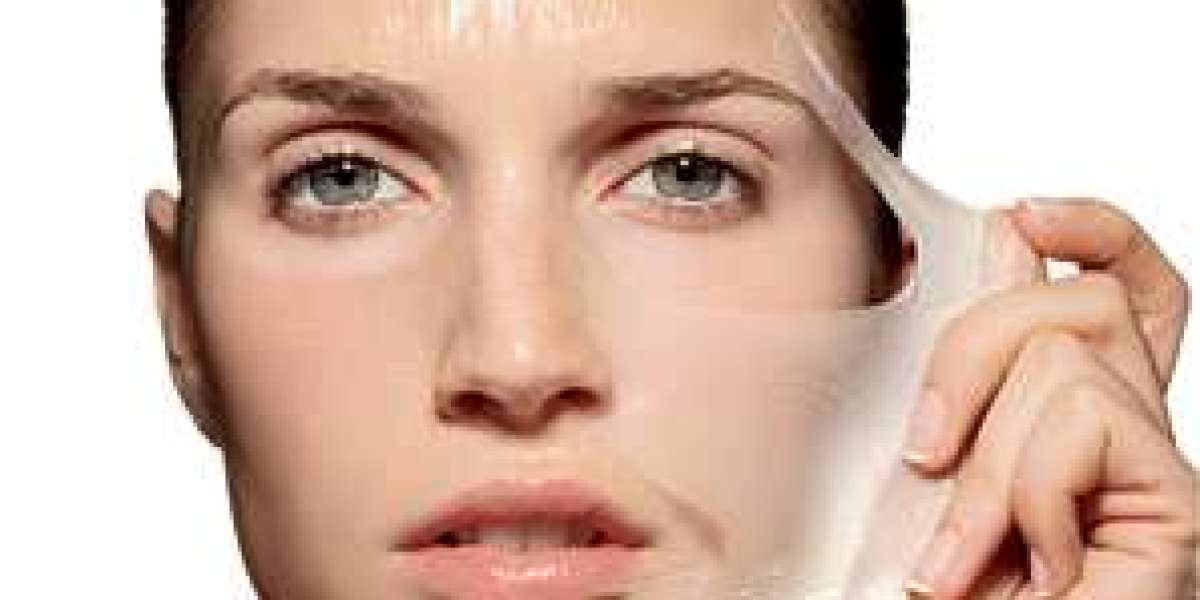 "Transformative Radiance: Superficial Chemical Peels Decoded"