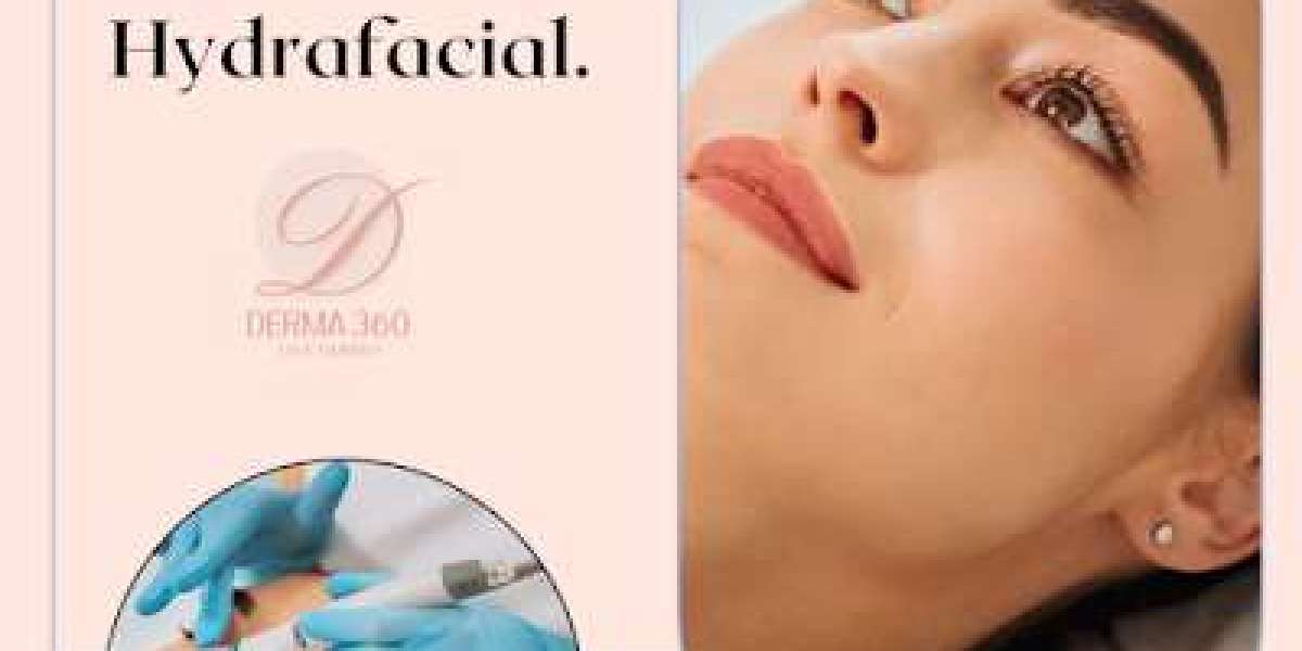 Unveiling Radiant Skin: HydraFacial Treatment at Derma 360 for Revitalized Complexions