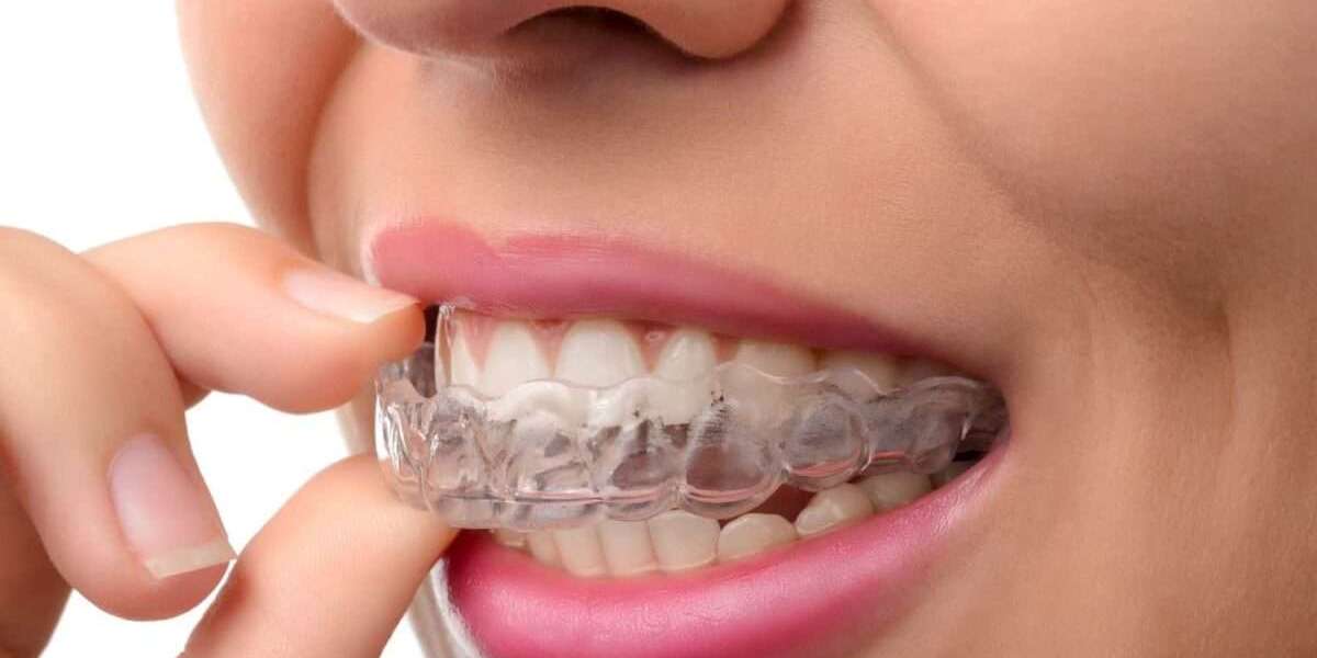 Smile Saviors: How Mouth Guards Preserve Your Pearly Whites