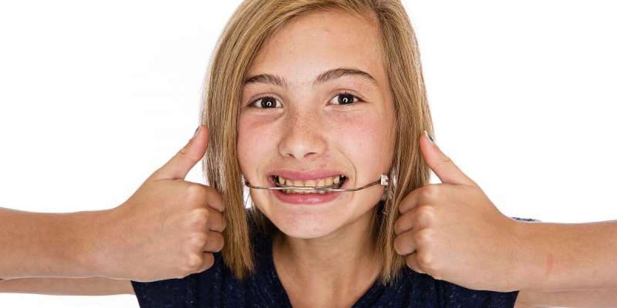 Beyond the Bite: Head-Fixed Orthodontics and Its Transformative Impact