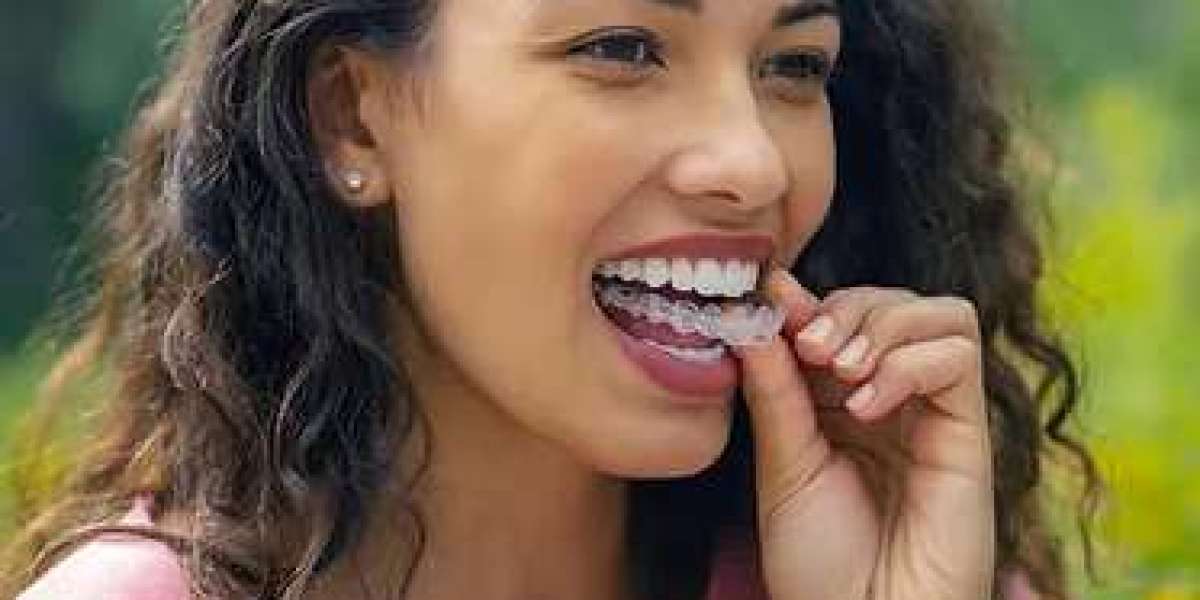 Transform Your Smile: Invisalign & Spark Clear Aligners in London