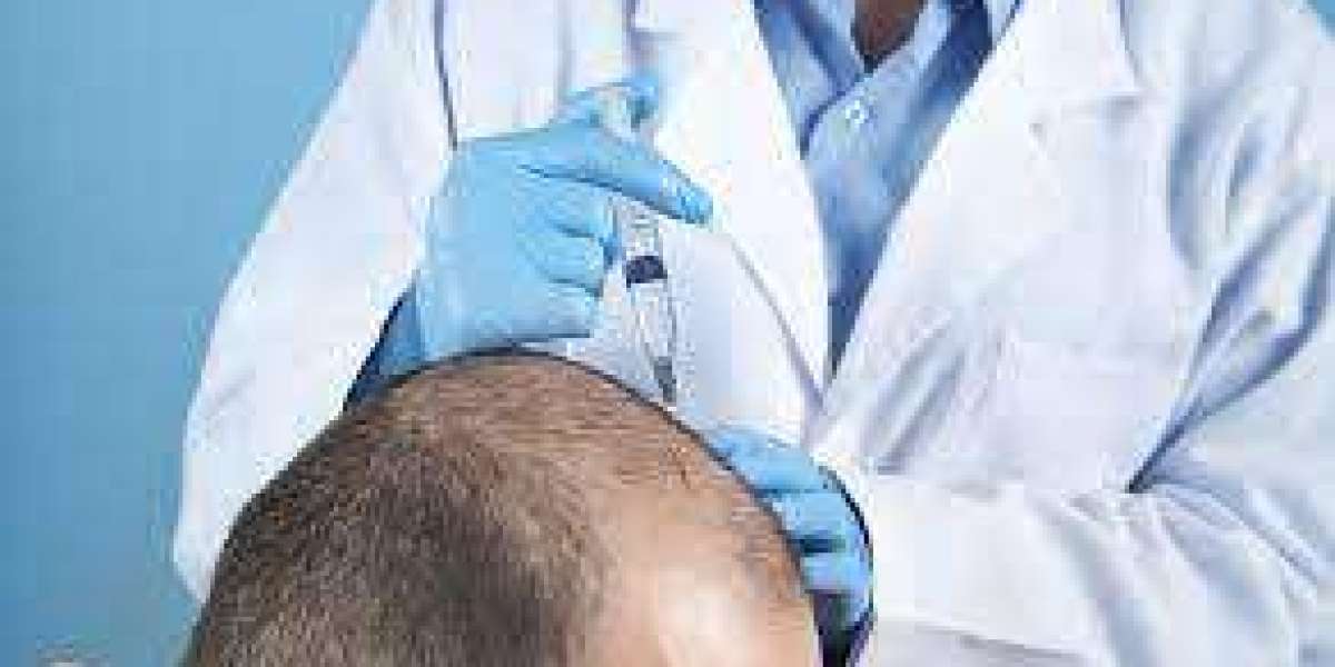 What Are the PRP Best Hair Treatments in Dubai?