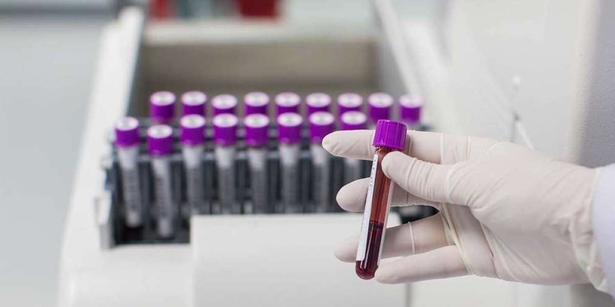 Unlocking Health Secrets: How Blood Tests Illuminate Disease Detection