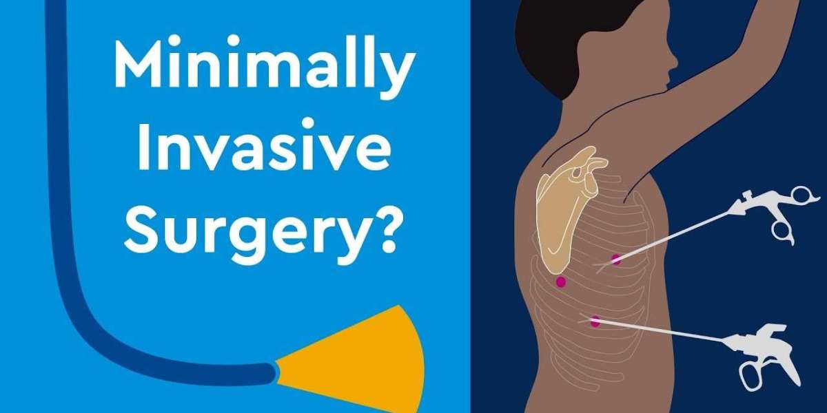 Benefits Of Minimally Invasive Surgery