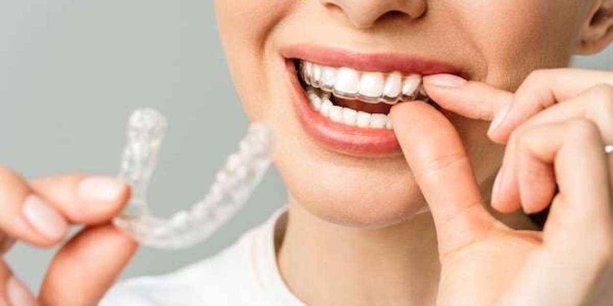 How Invisalign Melbourne Can Help You Achieve a Straight and Beautiful Smile