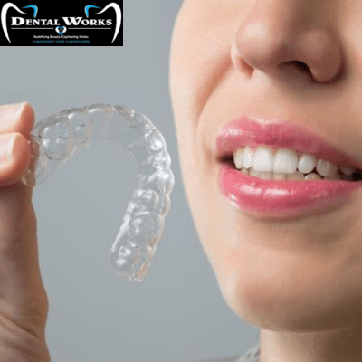 Rely On The Best Dental Implant Clinic In Delhi For Exclusive Facilities | by Dental Works Clinic | Dec, 2023 | Medium