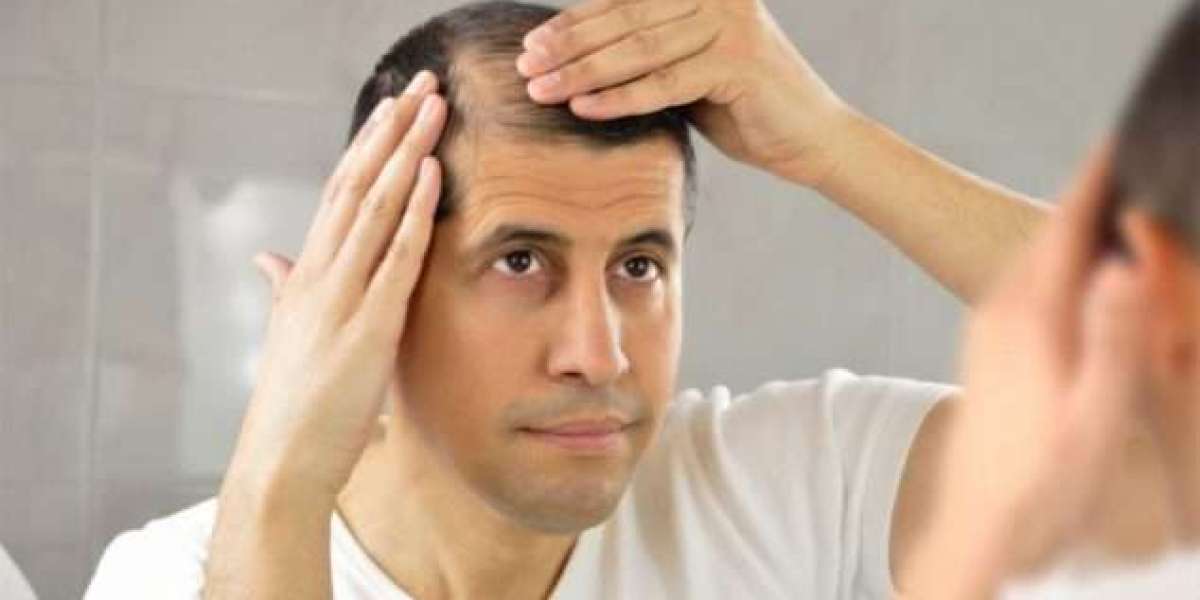Regain, Restore, Renew: Your Complete Guide to Hair Transplant Options"