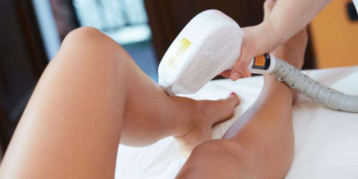 Flaunt Your Smooth Side: Permanent Laser Hair Removal Unveiled