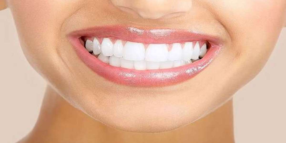 Cost Breakdown: Teeth Whitening Prices in Dubai