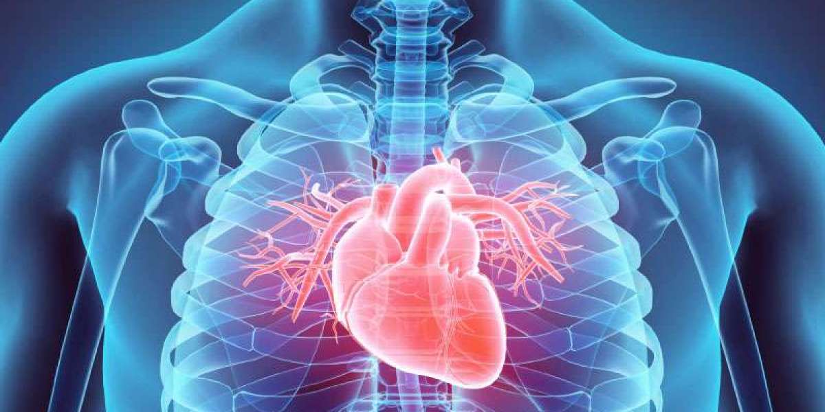 7 Simple Steps To Avoid A Heart Attack