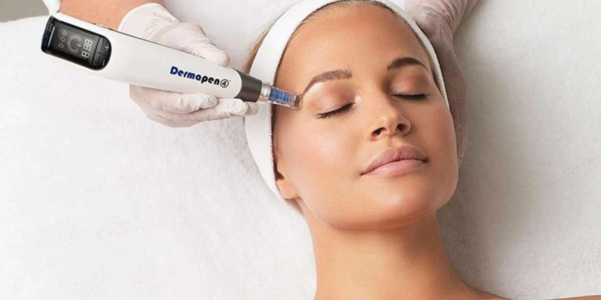 Dermapen Decoded: Crafting Beauty, One Needle at a Time