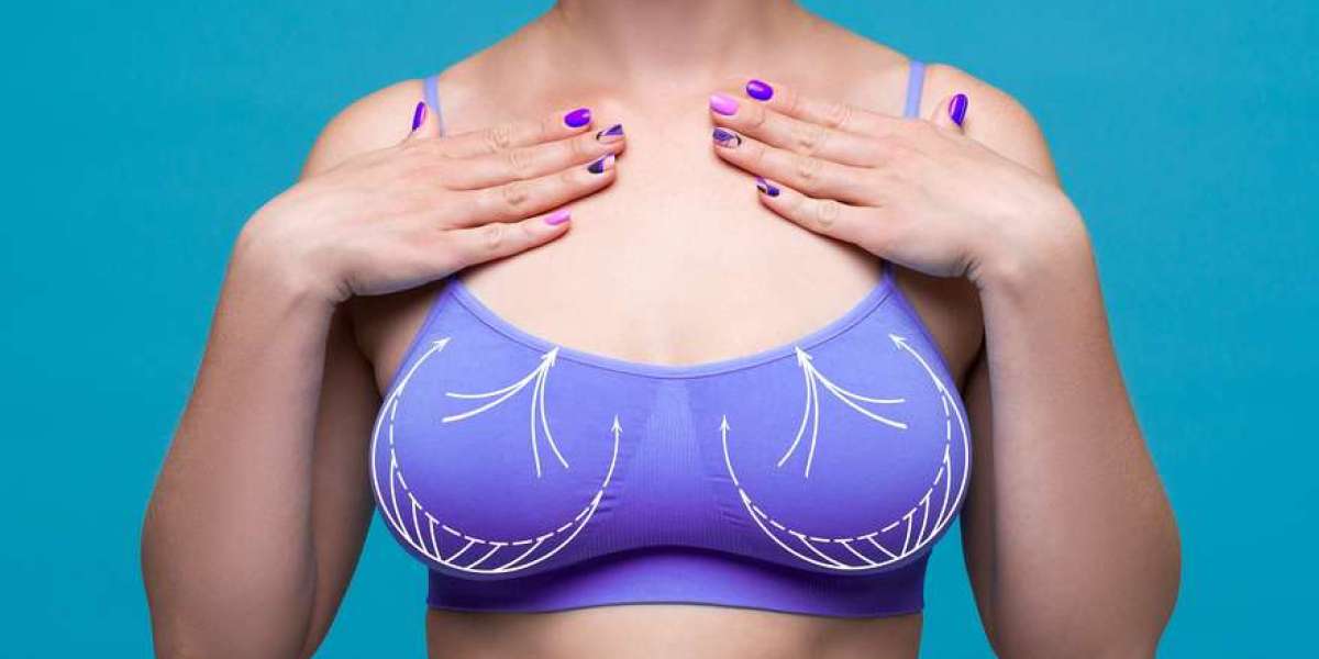 Ageless Elegance: Your Guide to Timeless Breast Lifts