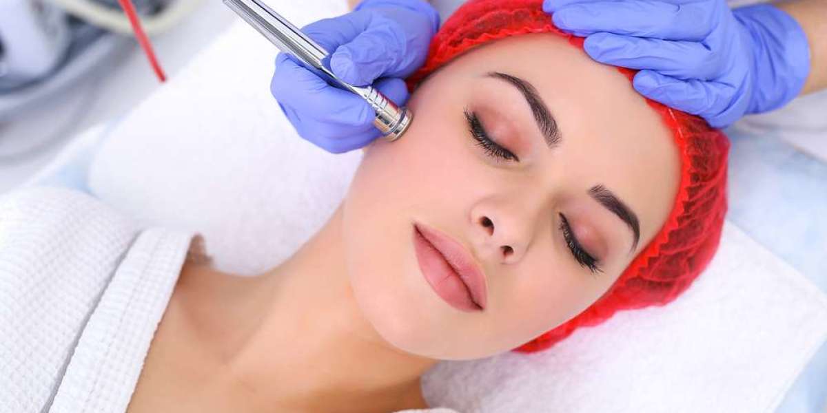 Professional Acne Treatment Services in Dubai