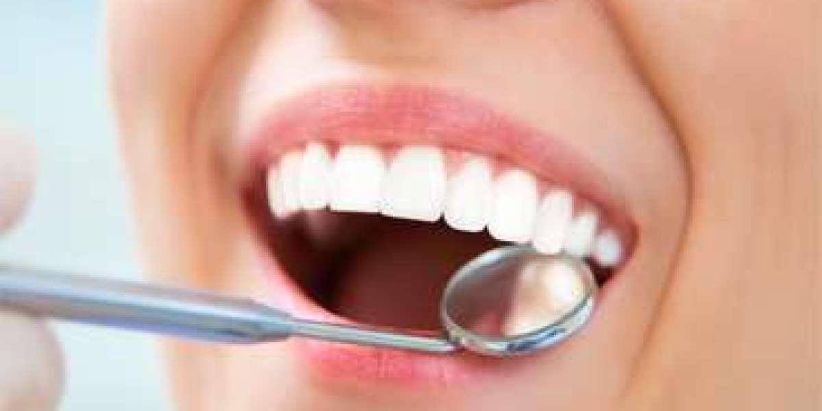 Natural Teeth Whitening Remedies You Can Try at Home