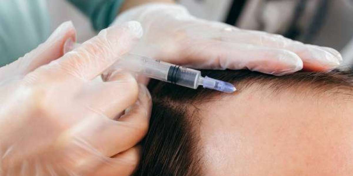 Dubai's Haircare Revolution: Plasma Injections Steal the Show