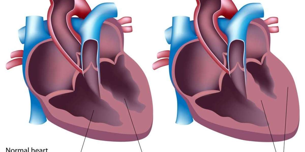Genetic Cardiomyopathies Market Analysis Report: Size, Growth, and AI's Role in Diagnosis and Management
