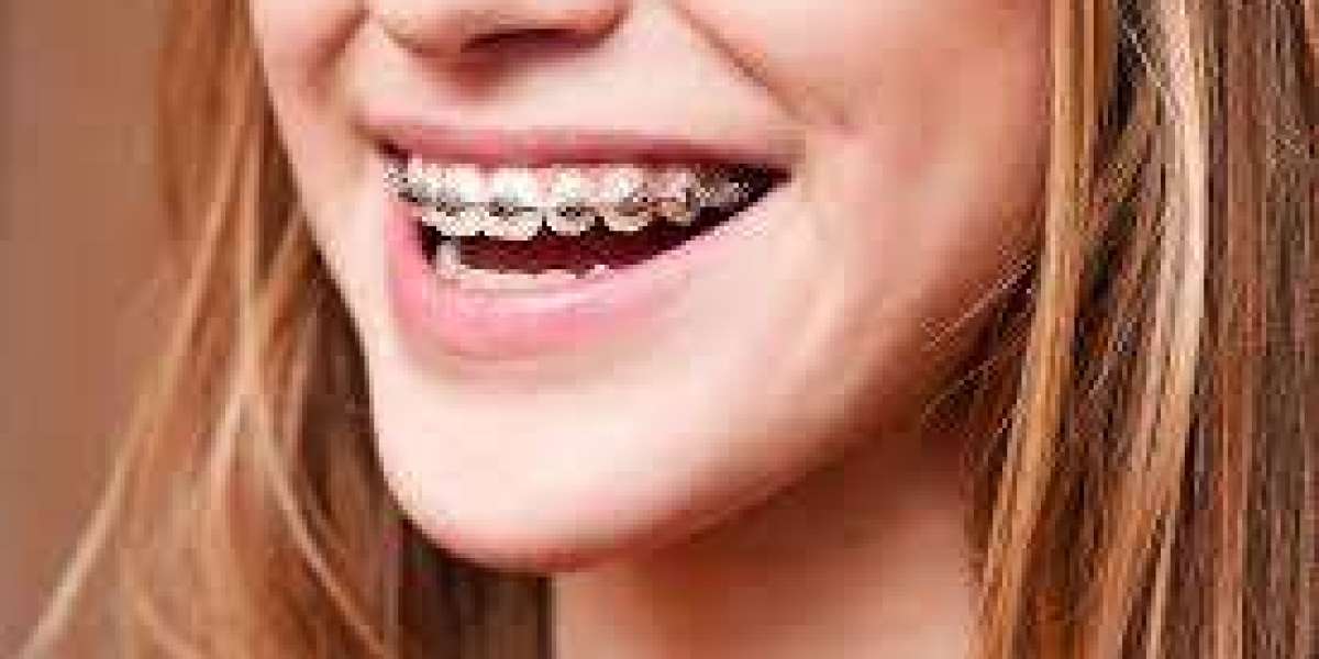 Dubai's Celebrity Smiles: The Influence of Orthodontics