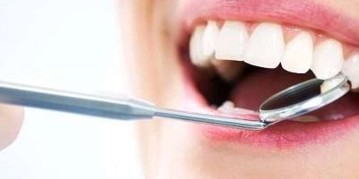 Full Mouth Rehabilitation: A Lifelong Investment in Oral Health