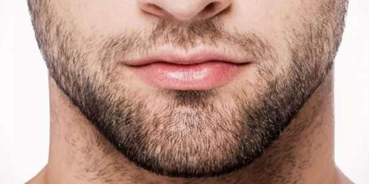 Powerful Tips To Help You Beard Hair Transplant Better