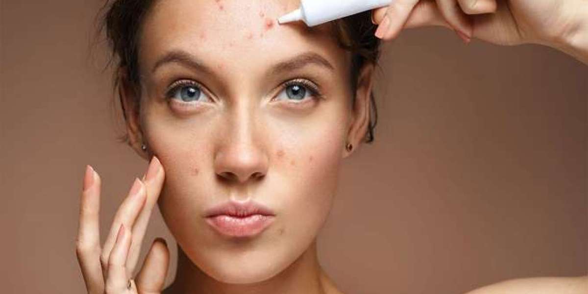 Zap Those Zits: The Latest in Pimple Treatment Technology