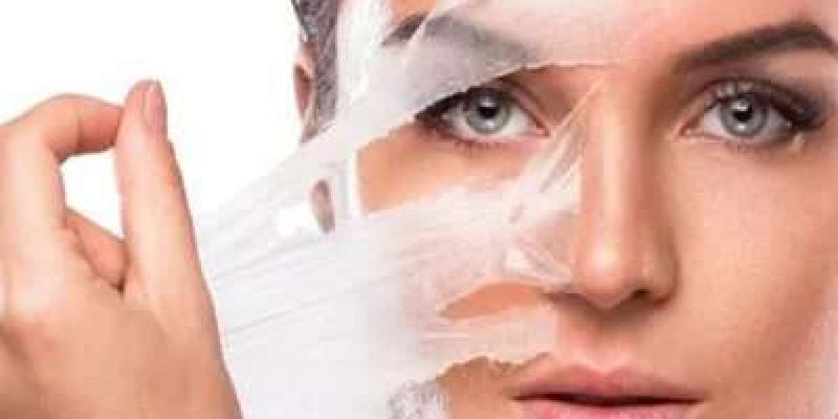 Chemical Peels for Acne Scars: A Dermatologist's Perspective