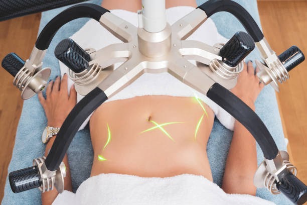 Contours of Confidence: Laser Liposuction in Riyadh