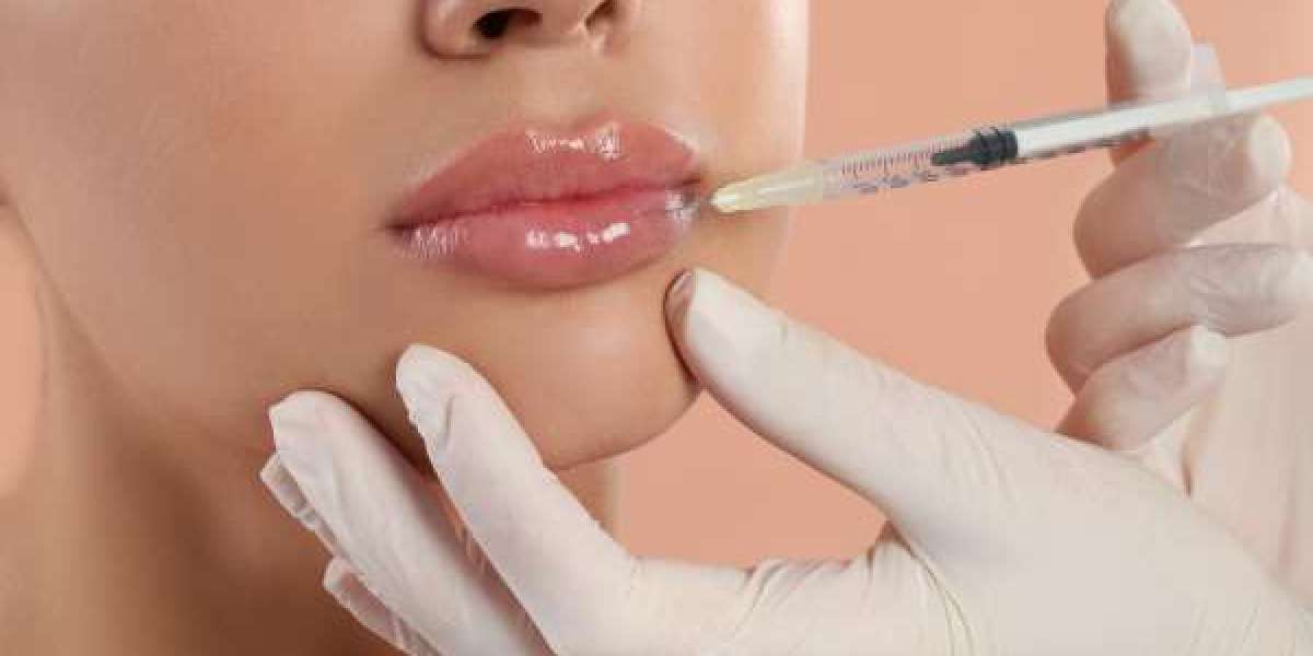 The Psychological Appeal Fueling Lip Augmentation Trends