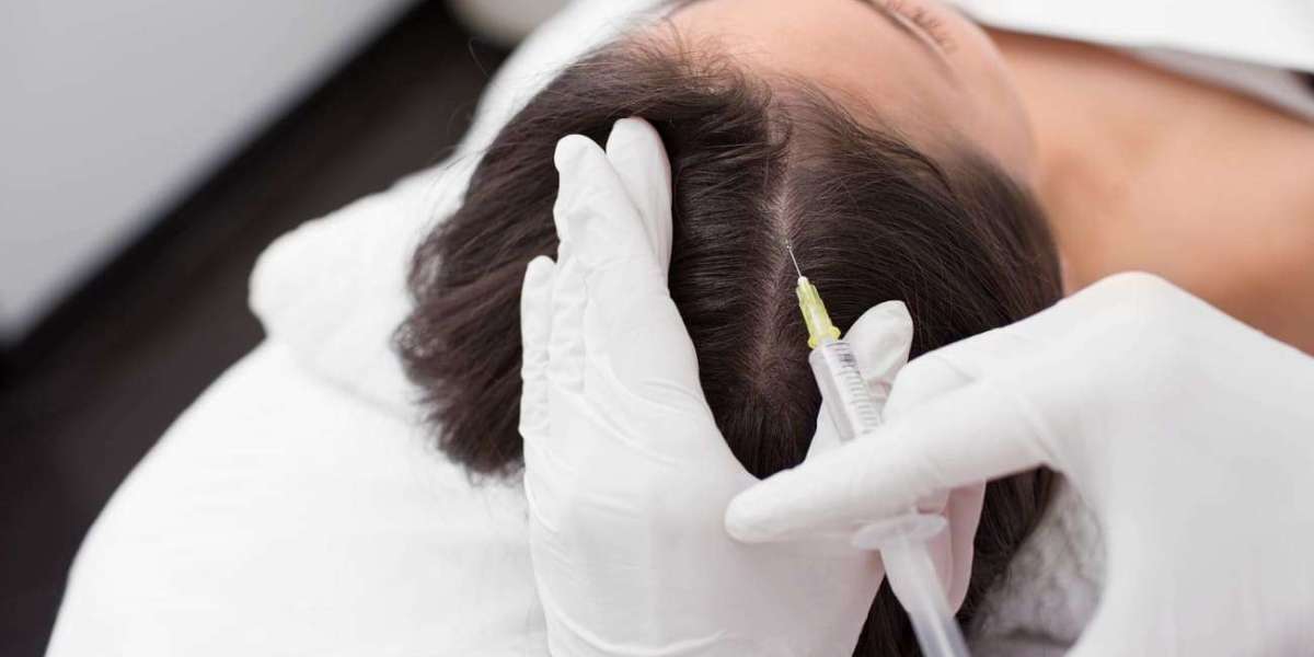 Hair Revival in the City of Gold: The Dubai Guide to Stem Cell Transplants