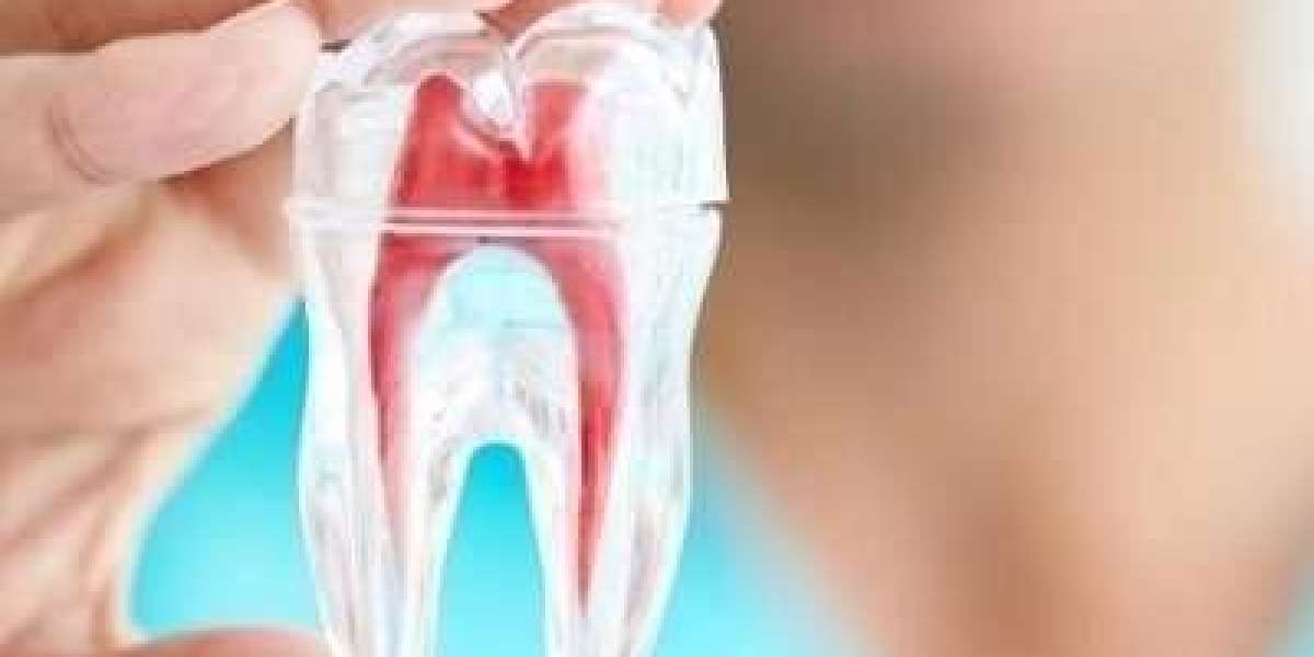 Root Canal and Dental Bridges: Enhancing Your Smile