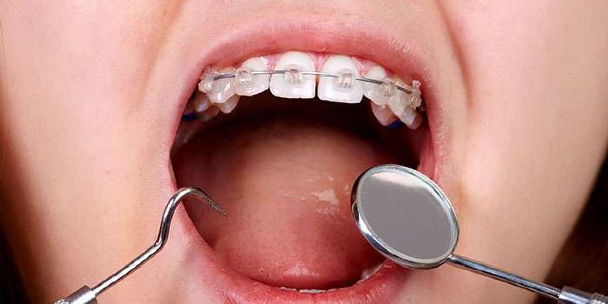تحول ابتسامة دبي: جوهر الانسجام بين الأسنان والوجه