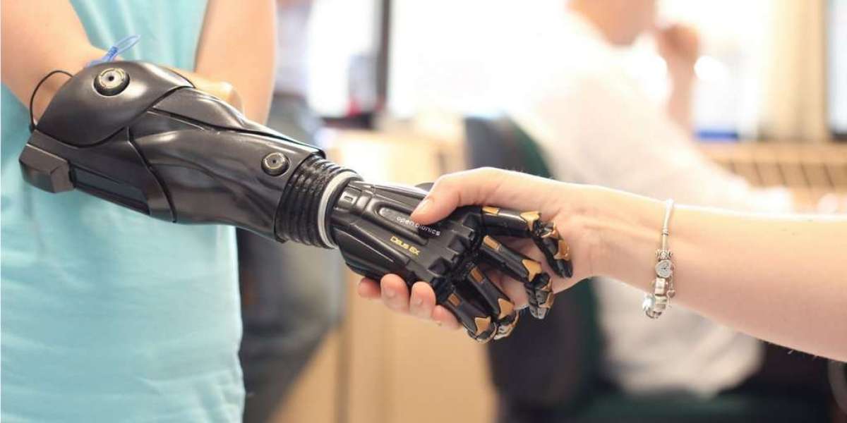 Bionic Prosthetics Is Estimated To Witness High Growth Owing To Rapid Technological Advancements