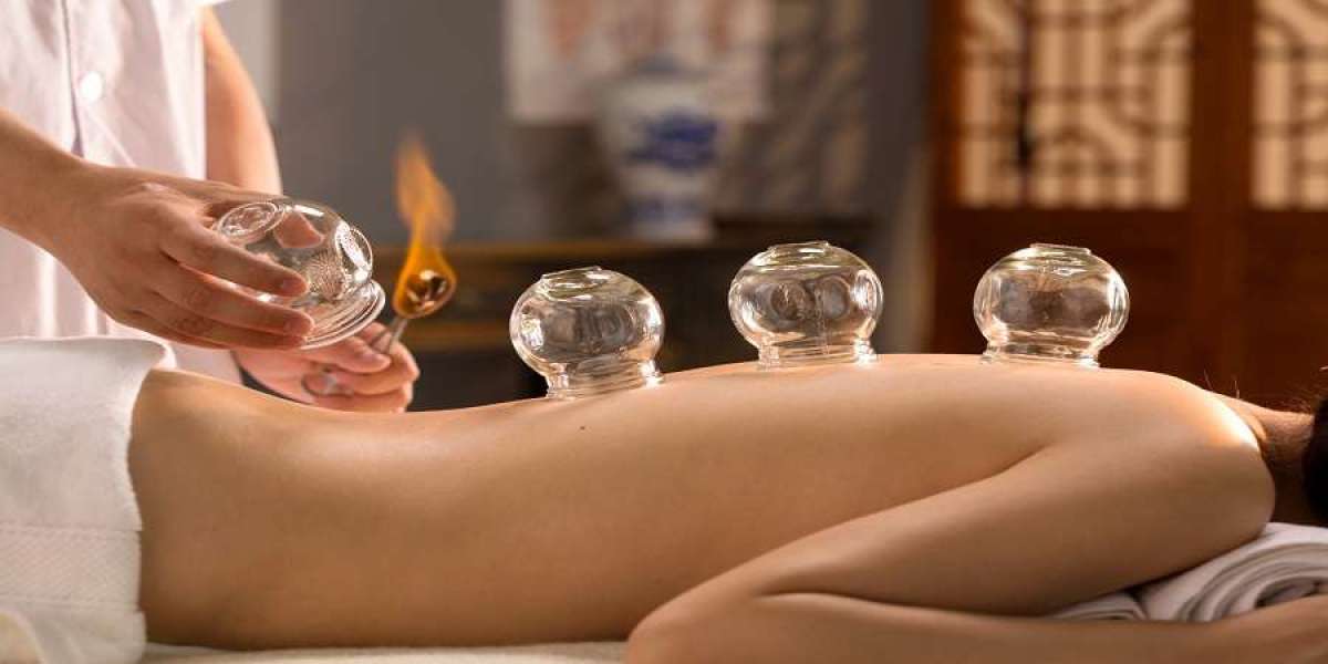 Cupping Therapy in Dubai: A Fusion of Ancient Healing and Modern Wellness