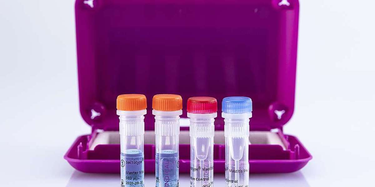Global QPCR Test for Mastitis Market Size, Share, Trends and Forecast 2022 – 2032