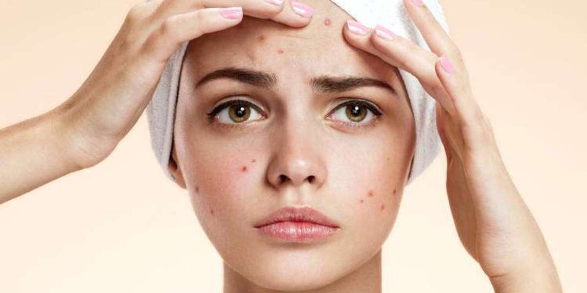Dubai's Dermatology Elite: Your Key to Perfect Skin