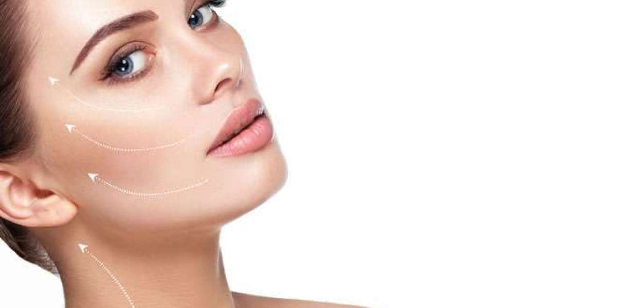 Top Questions on Double Chin Removal Answered